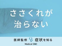「ささくれが治らない」原因はご存知ですか？医師が徹底解説！