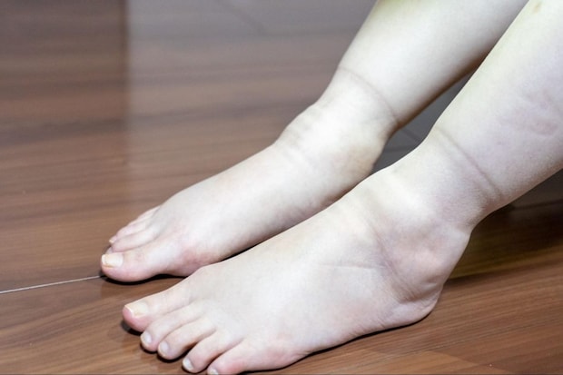 注意したい腎臓病のサインと受診の目安