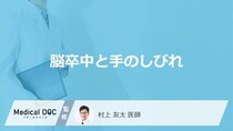 「脳卒中の初期症状」として疑われる「手のしびれ」の特徴はご存知ですか？【医師解説】
