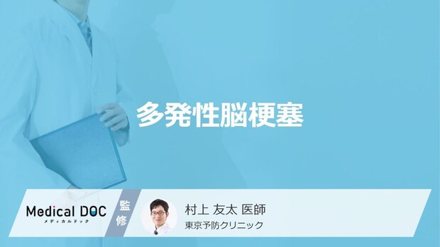 「多発性脳梗塞」の症状・原因はご存知ですか？医師が解説！