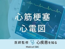 「心筋梗塞を疑う心電図」の波形や経過はご存知ですか？部位診断でわかることも解説！