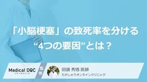 「小脳梗塞」の致死率を分ける“4つの要因”とは？ 重症化する病態、しにくい病態【医師監修】