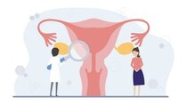 どんな症状があると『子宮内膜症』？ リスクが高い人に当てはまる「7項目」とは？【医師解説】