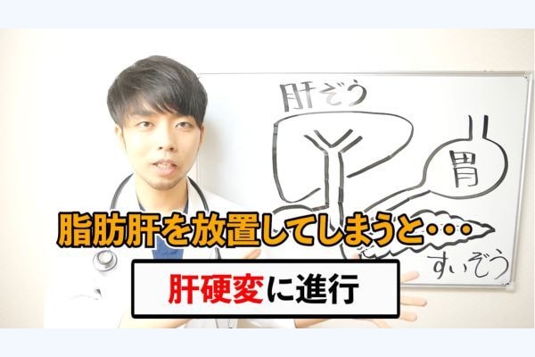 脂肪肝、放置すると「かさぶた」のように硬くなりがんのリスクも