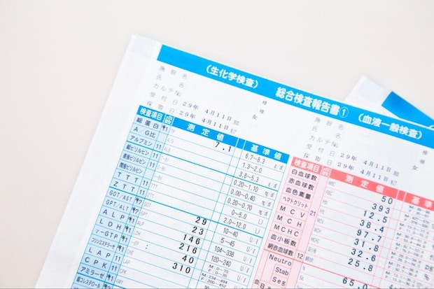 膠原病の血液検査で見る主な項目