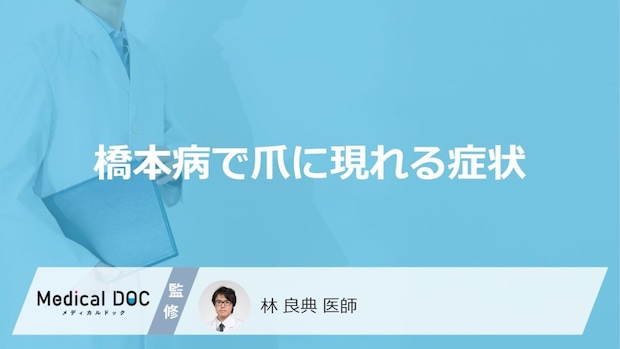 「橋本病」を発症すると「爪」にどんな症状が現れるかご存知ですか？【医師監修】
