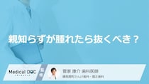 親知らずの腫れは抜歯が必要？抜く・抜かないの判断基準と処置後の痛みについて【医師解説】