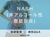 「NASH(非アルコール性脂肪肝炎)」はアルコールの摂取とは関係なく発症する？