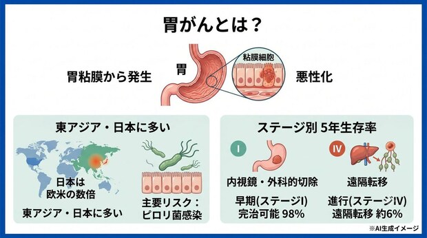 胃がんとは？