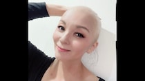 【闘病】“魅せる”モデルが右胸を全摘。『トリプルネガティブ乳がん』を乗り越えた今
