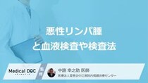 「悪性リンパ腫」は血液検査で確認すべき7つの数値はご存じですか？ 検査法を医師が解説！