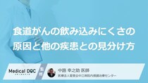 「食道がん」が発するごく初期のサイン｜サイレントキラー特有の自覚症状の現れ方