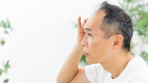 「AGA」は放置で進行するのをご存じですか？ 自然に治らない理由と治療の基本を医師が解説