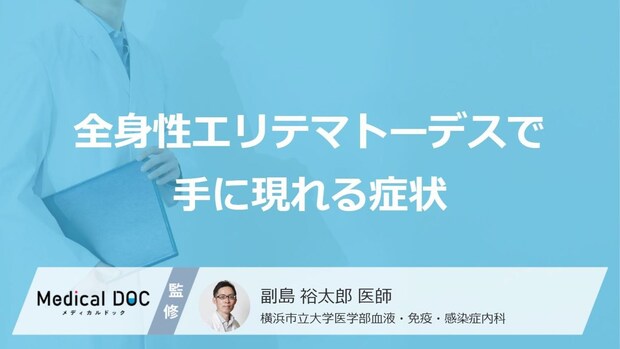 「全身性エリテマトーデス」を発症すると「手」にどんな症状が現れるかご存知ですか?