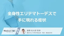 「全身性エリテマトーデス」を発症すると「手」にどんな症状が現れるかご存知ですか？