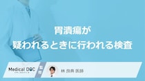 「胃潰瘍が疑われる場合に行われる検査」はご存知ですか？【医師監修】