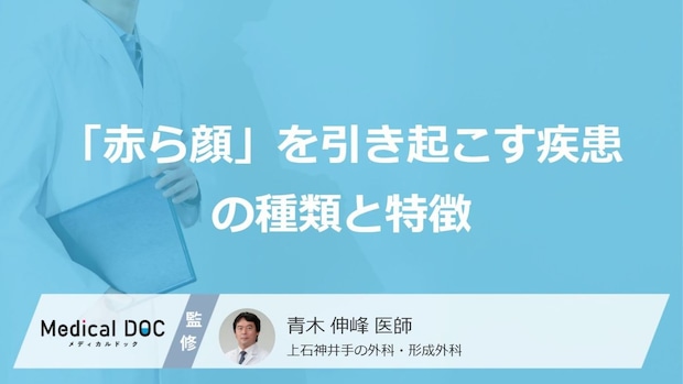 自己判断は逆効果?「赤ら顔」を引き起こす疾患の種類と特徴を専門医が詳しく解説