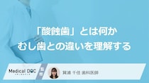 「歯が溶ける」“あの病気”とは？むし歯とは違う酸蝕歯の「原因」【歯科医師】