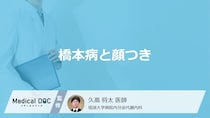 「橋本病」を発症すると「顔つき」にどのような特徴が現れるかご存知ですか？医師が解説