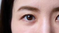 二重整形の埋没法は固定の『点数が多いほどよい』わけではない？ 選び方を医師が解説
