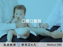 「口唇口蓋裂」とは？症状・原因・治療法についても解説！【医師監修】