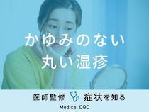 「かゆみのない丸い湿疹」ができる原因はご存知ですか？医師が対処法も徹底解説！