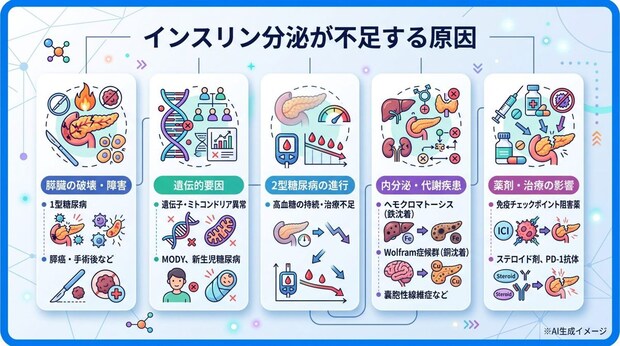 インスリンの分泌が不足する原因