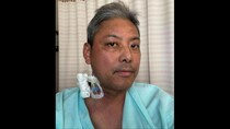 【闘病】突然のしびれで難病『自己免疫性ノドパチー』に。当たり前が奪われた絶望の日々
