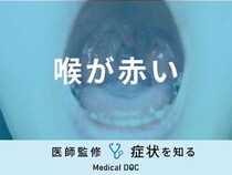 「喉が赤い」ときにやってはいけないことはご存知ですか？医師が徹底解説！