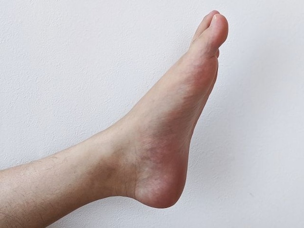 はじめは違う診断名を受ける