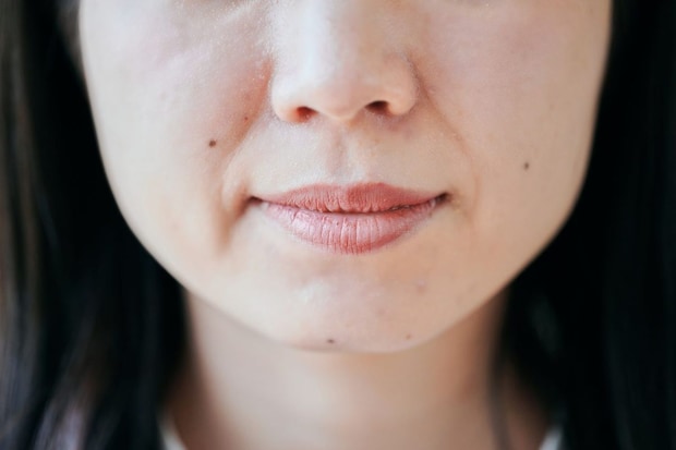 鼻整形にはどんな方法があるの？