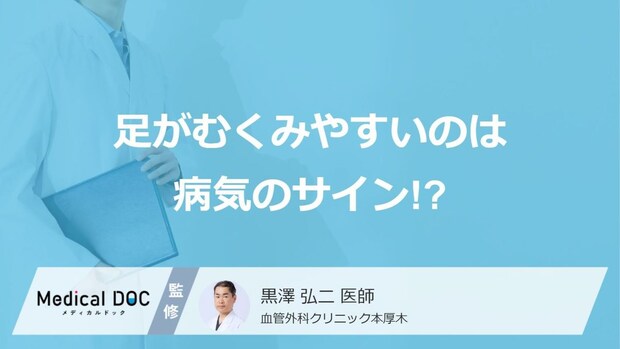 足のむくみやだるさは病気のサイン?「下肢静脈瘤」の原因や初期症状を医師が解説