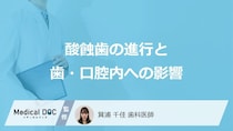 酸蝕歯が進行すると歯や口腔内にどのような影響が出るか