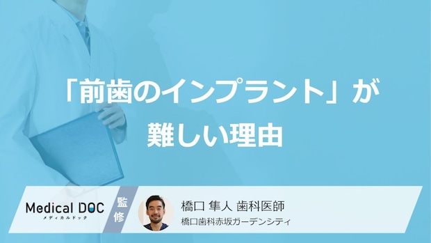 「前歯のインプラント」が難しい理由を歯科医師が解説 『1mmのズレも大きな差』