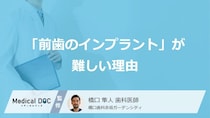「前歯のインプラント」が難しい理由を歯科医師が解説 『1mmのズレも大きな差』