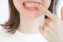 「嚙み合わせ」が悪いとどんな状態になるかご存知ですか？医師が監修！