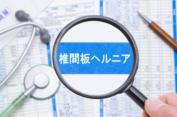 椎間板ヘルニアとはどのような病気？