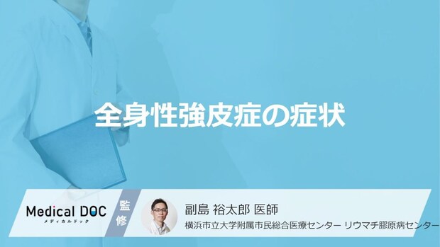 30〜50代女性に多い「全身性強皮症」の検査・治療法はご存知ですか？【医師監修】