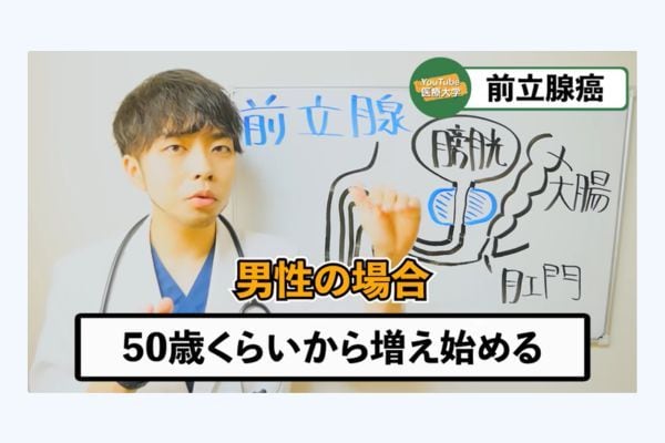 前立腺がんは「男性が最もかかりやすいがん」――生涯2人に1人が発症