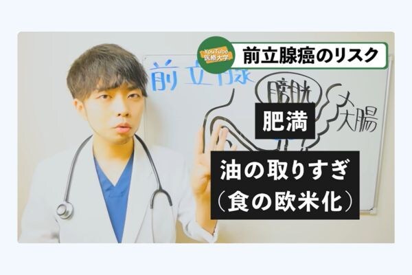 前立腺がんの発症リスクが高い人の「2つの特徴」