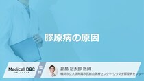 「膠原病の原因」はご存知ですか？【医師監修】