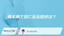 「橋本病」を発症すると「目」にどんな症状が現れる？受診の目安となる症状も解説！