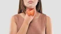 『甲状腺』の異常を真っ先に知らせる「TSH」、高い・低いが示す意味をご存じですか？