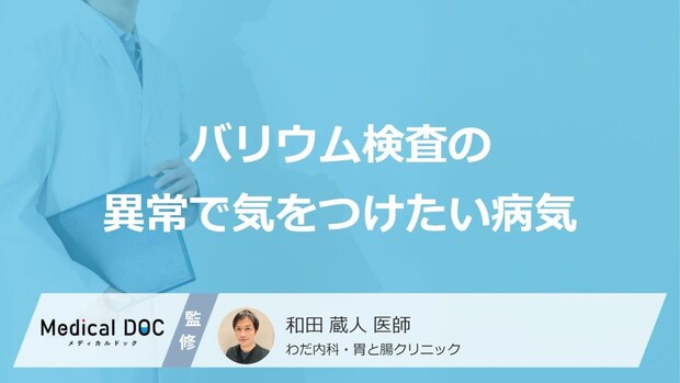 「バリウム検査」の異常で気をつけたい”4つの病気”はご存じですか?医師が解説!