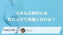 なぜ「スキルス胃がん」は”胃カメラで見落とし”されやすい？早期発見のコツも医師が解説！