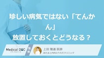 決して珍しくない「てんかん」の放置リスクを解説！早期発見と適切な検査の重要性