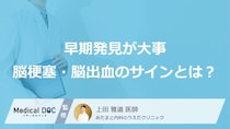 突然起こる「脳梗塞」「脳出血」の初期症状と見逃してはいけない前兆を医師が解説
