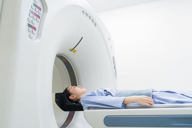 再発性多発軟骨炎の診断確定までには2年以上かかった