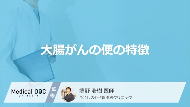 「大腸がん」の疑いがある際の対処法はご存知ですか?医師が徹底解説!