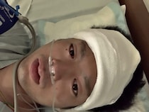 【闘病】新卒2か月で『脳腫瘍』の多発転移「人生終わった…」 てんかんの後遺症も